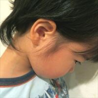 子どもに多い耳の病気って何？