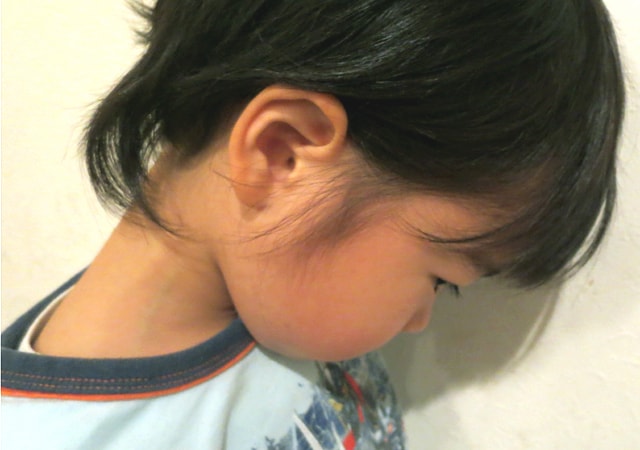 子どもに多い耳の病気って何？