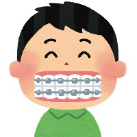 小児矯正と成人矯正の違いって何？