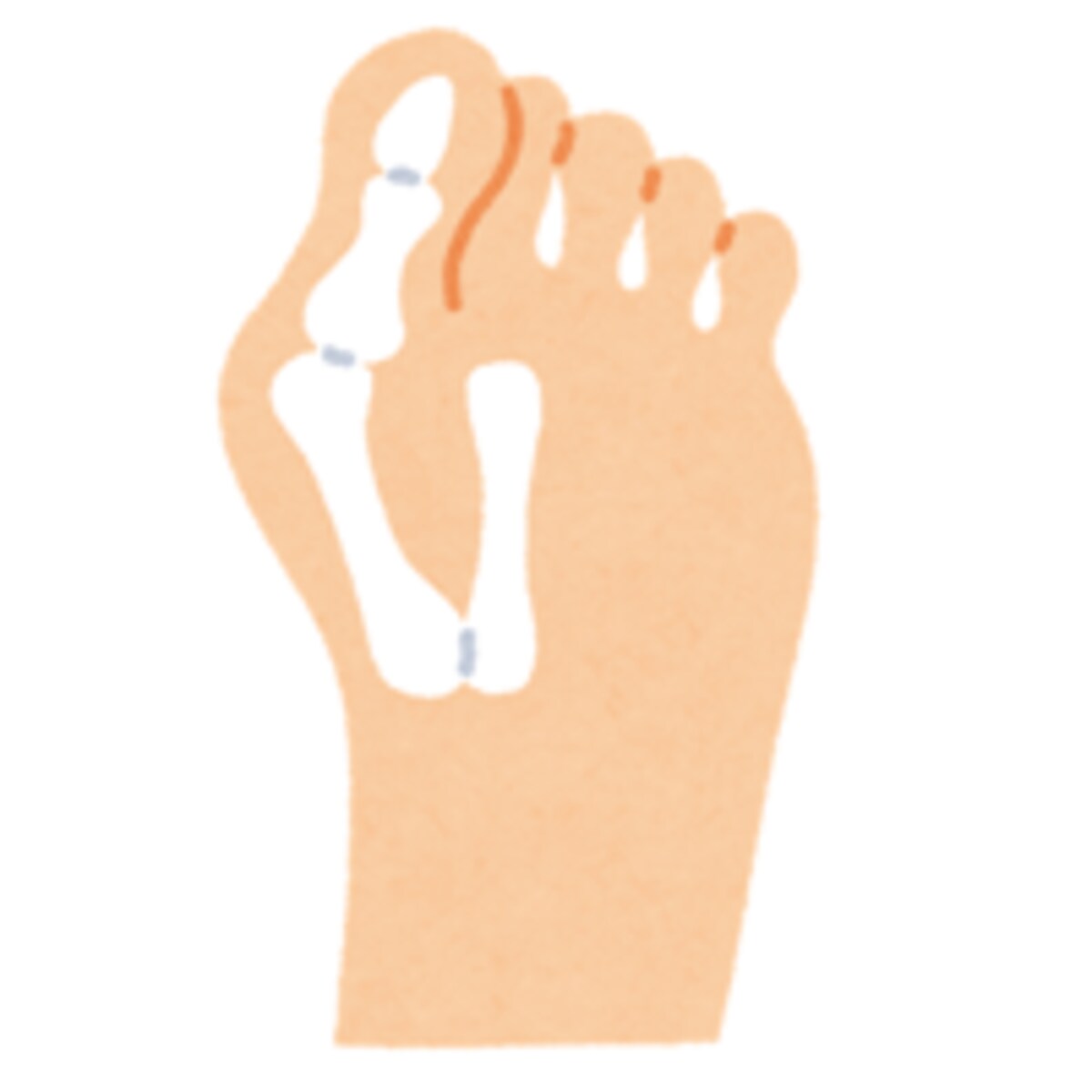 急増！子どもの足トラブルいろいろ