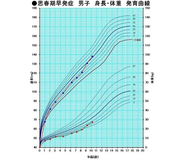思春期早発症 男子 身長・体重 発育曲線