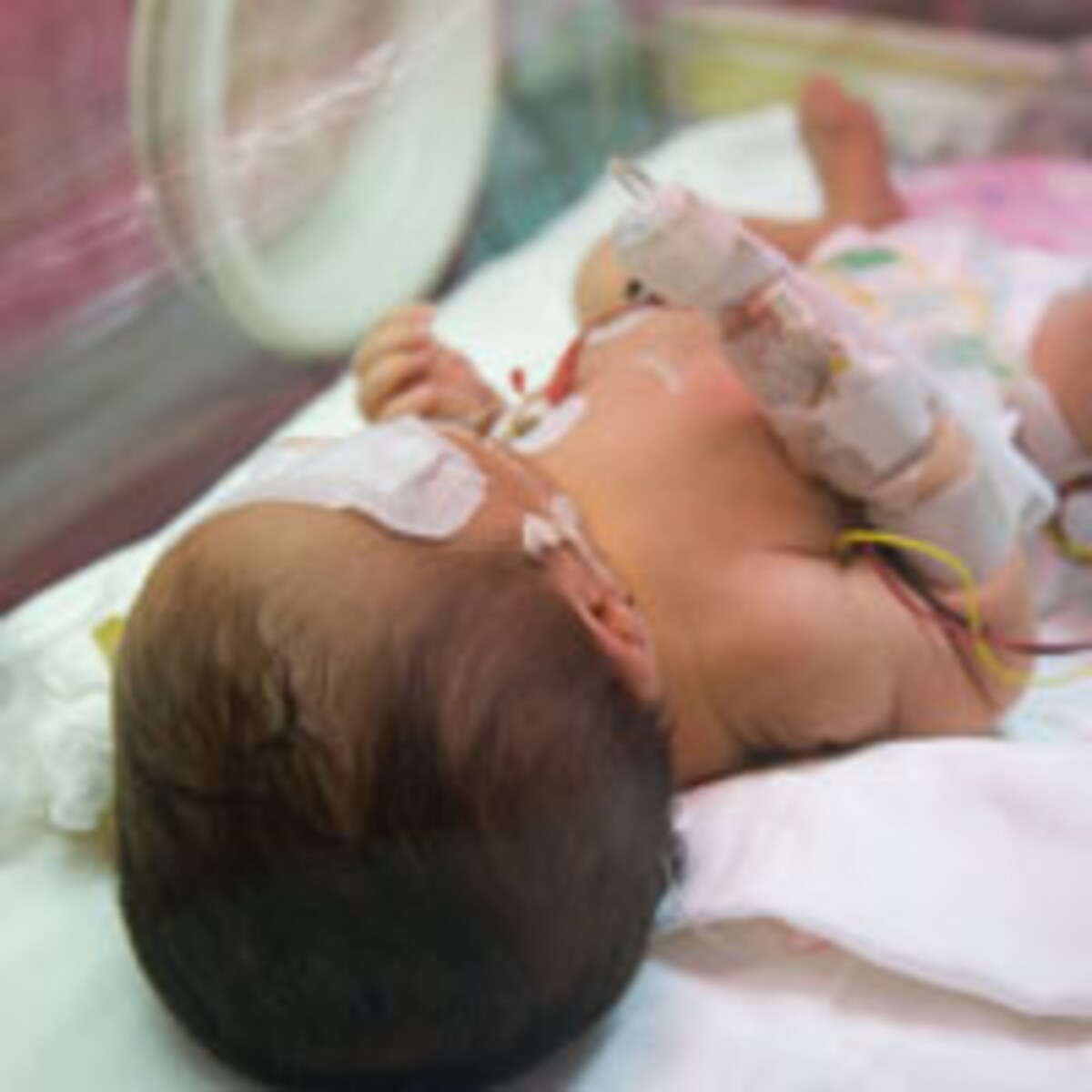 「未熟児」という言い方が今はされない理由