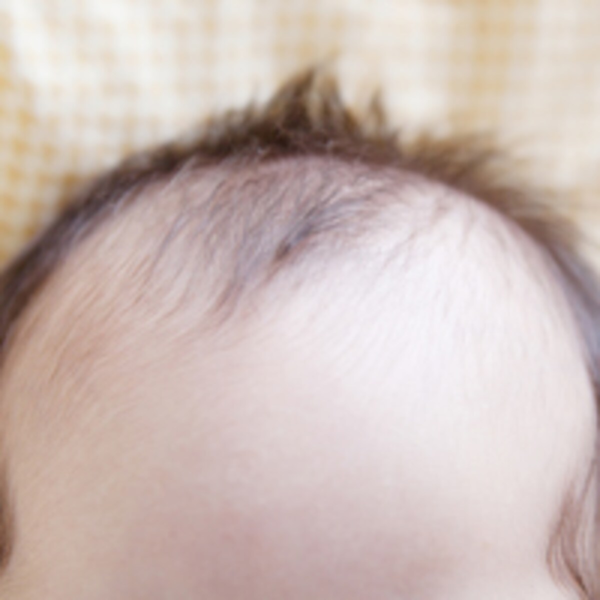 子どもの抜け毛の原因は何が問題？