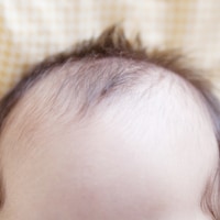 子どもの抜け毛の原因は何が問題？