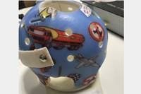 気になる赤ちゃんの頭の形【頭のヘルメット】ってどんなもの?