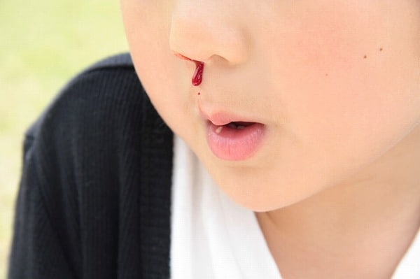 【ちょいムズ】全問わかる？ママぢから検定「子どもの健康編」