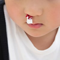 【なぜ？】子どもの鼻血が出やすい原因は●●だった