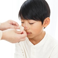 誤った応急処置に注意! 鼻血の正しい止め方