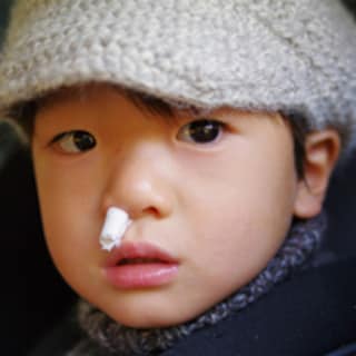 子どもの鼻血が止まらない 危ない出血量の判断基準は？