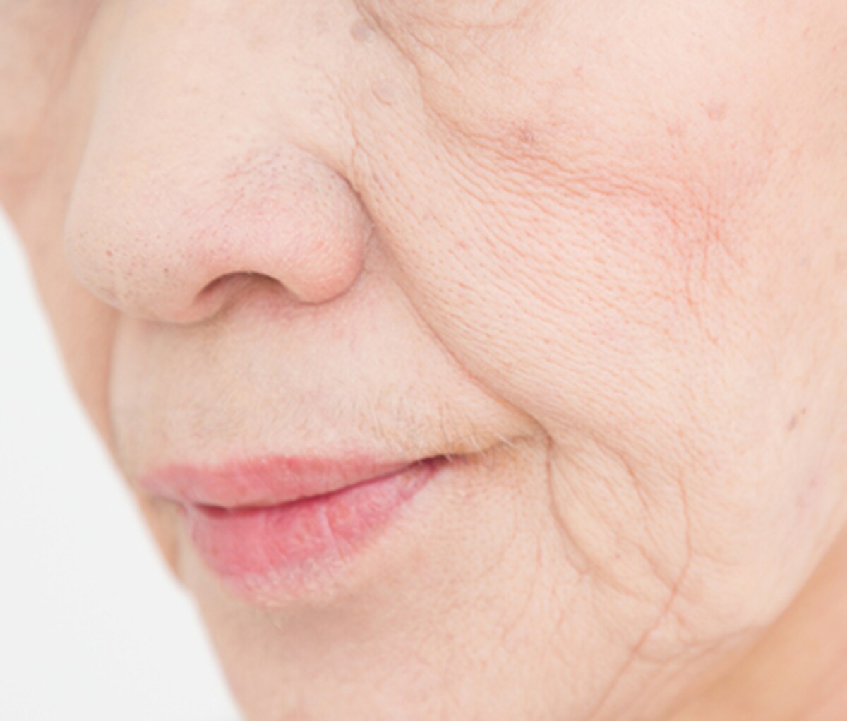 ほうれい線には「サージカルテープ」が効果的！正しい貼り方は？