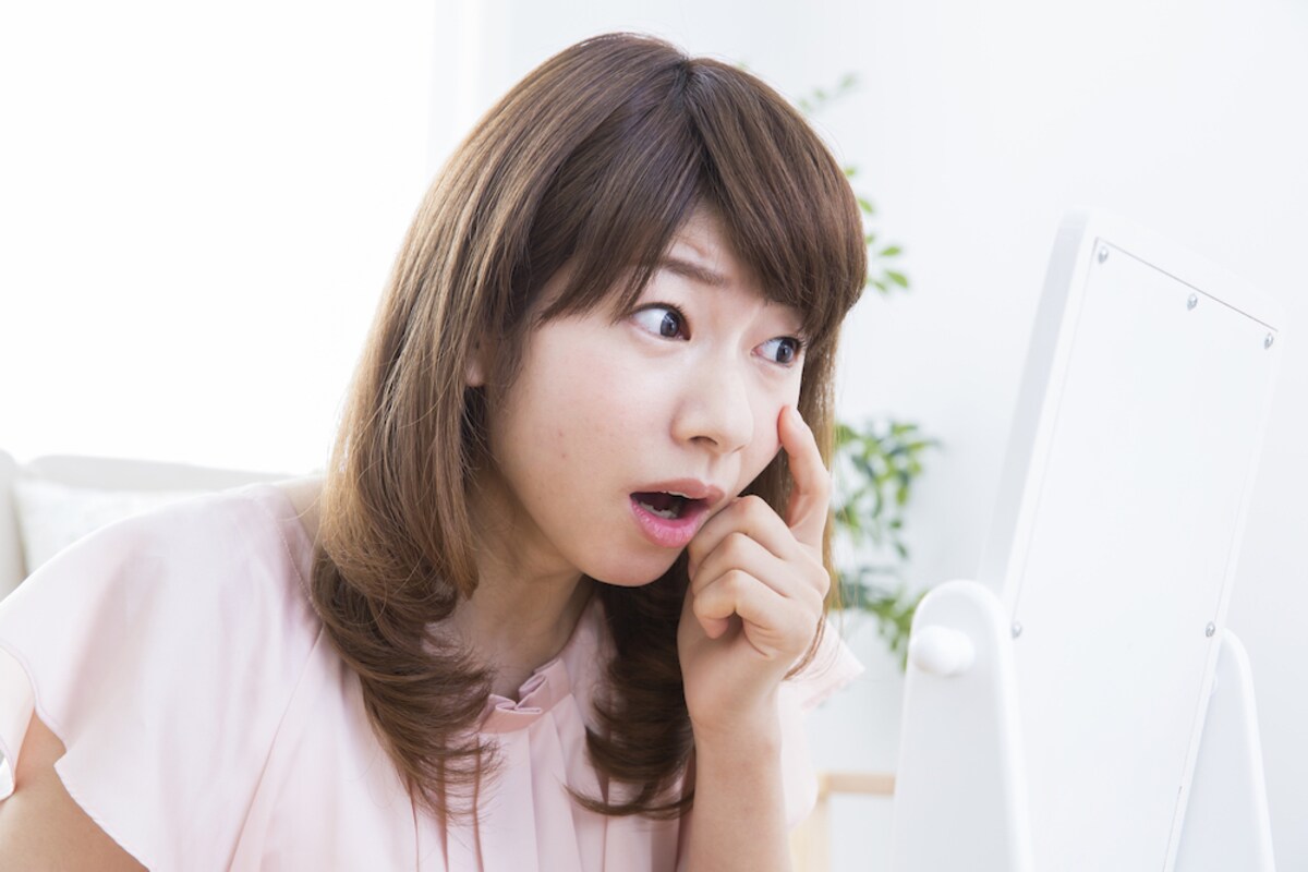 美容皮膚科医に聞く！　アラサー女子のシミのレーザー治療