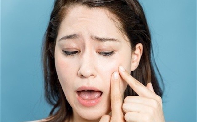 完全版!大人ニキビ5つの原因と治し方|スキンケア対策・皮膚科~予防