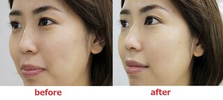 【保存版】気になる部分を自然にカバー！　コンシーラーの基本使いテクニック