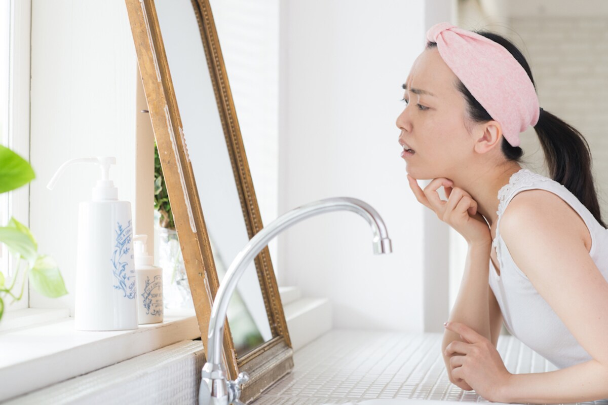 皮膚科医に聞いた！  20代のニキビケアはどうするのが正解なの？