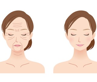 「ゴルゴ線」と呼ばれるミッドチークラインを目立たなくするには？