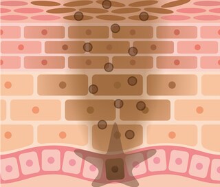 いつのまにか乳首は黒ずんでいく！あの頃のピンク乳首に戻す方法は？