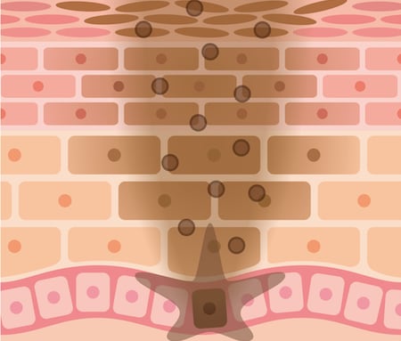 いつのまにか乳首は黒ずんでいく！あの頃のピンク乳首に戻す方法は？