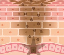 いつのまにか乳首は黒ずんでいく！あの頃のピンク乳首に戻す方法は？