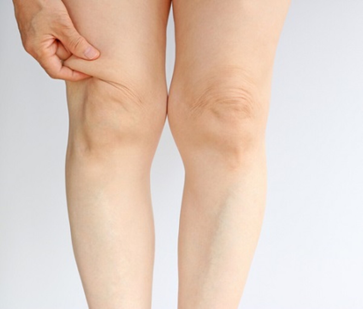 オバサン脚の原因?! もたつくひざ周りをスッキリさせて脚ヤセ！