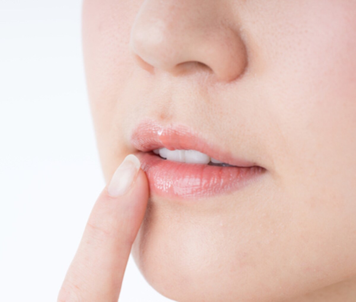 SOS！唇が日焼けしてしまったときの緊急アフターケアのポイント