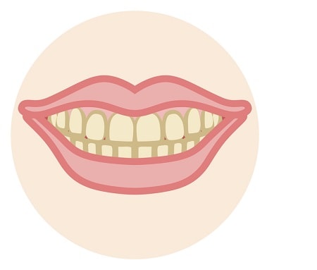 歯磨きしてても歯が黒っぽい！脱ステイン＆歯周病予防を導く歯磨き法