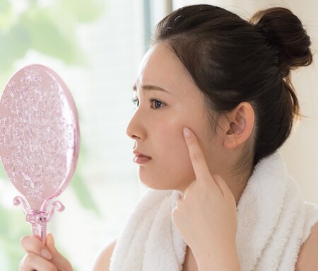 虫歯が原因で肌荒れするって本当!? 正しい予防法についてご紹介