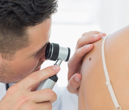 いつの間にか増えている?年齢とともに増える「ほくろ」の原因とは?