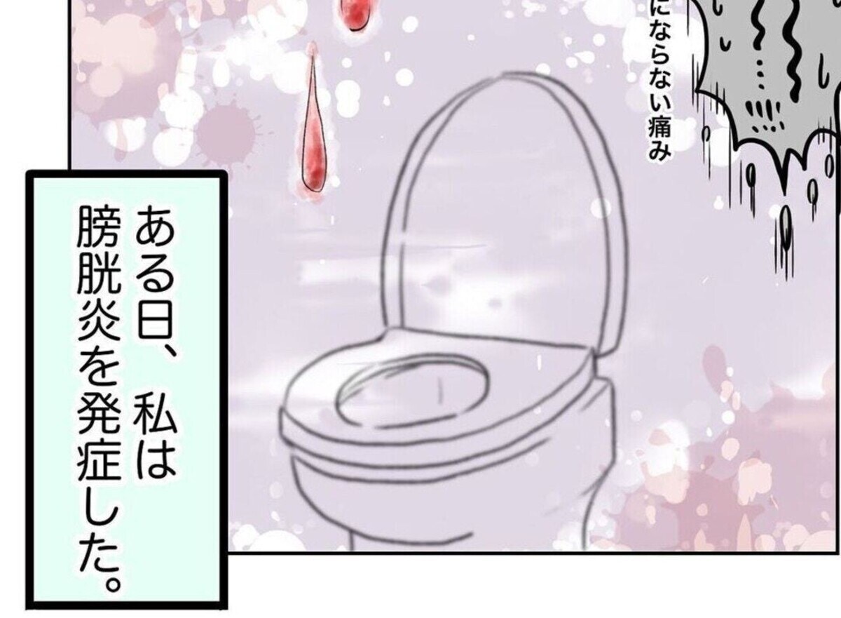 「やべ、これ膀胱炎かも」市販薬も効かない！ひどくなる症状に焦り｜トイレで寝たいと思った話　#前編