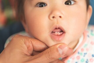 永久歯の本数は何本？生えかわり時期や抜ける順番についても解説