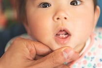 永久歯の本数は何本？生えかわり時期や抜ける順番についても解説