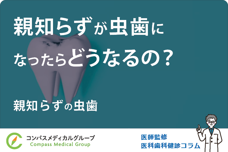 親知らずの虫歯 | 親知らずが虫歯になったらどうなるの？