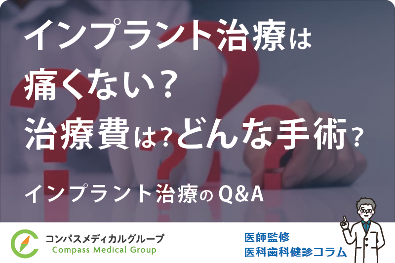 インプラント治療のQ&A | インプラント治療は痛くない？治療費は？どんな手術？