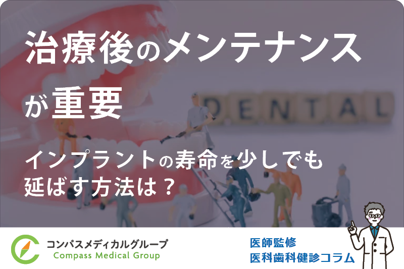 インプラントの寿命を少しでも延ばす方法は？ | 治療後のメンテナンスが重要