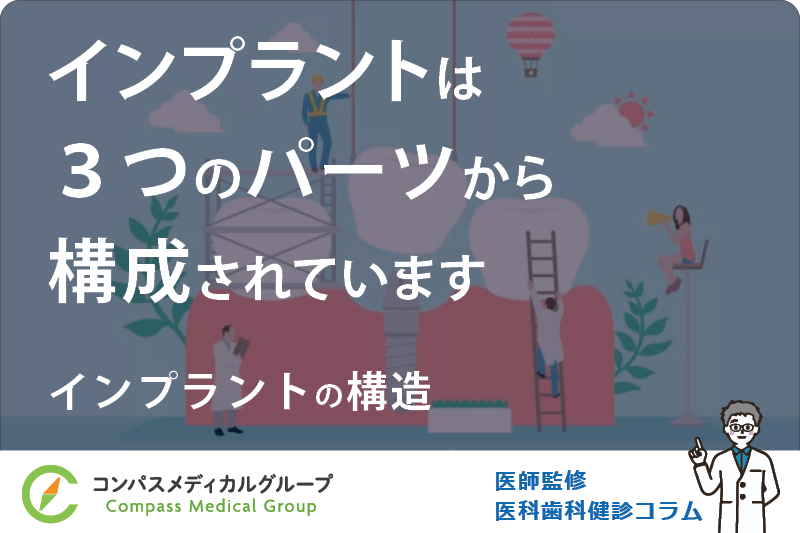 インプラントの構造 | インプラントは３つのパーツから構成されています