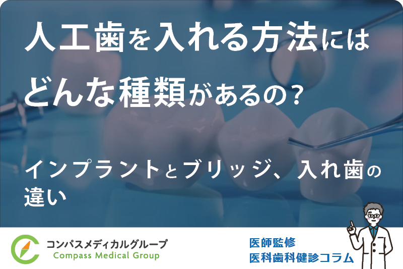 インプラントとブリッジ、入れ歯の違い | 人工歯を入れる方法にはどんな種類があるの？