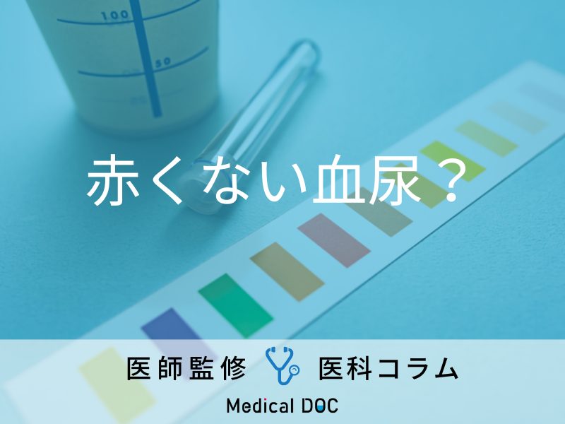 赤くなくても「血尿」と診断されることがある？ 血尿とはどんな状態なのか医師が解説