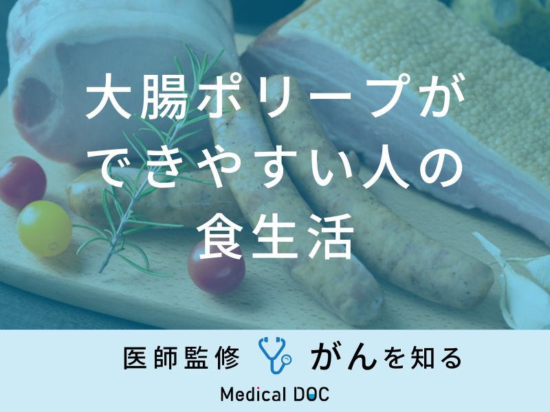 「大腸ポリープができやすい人の食生活」はご存知ですか？医師が徹底解説！