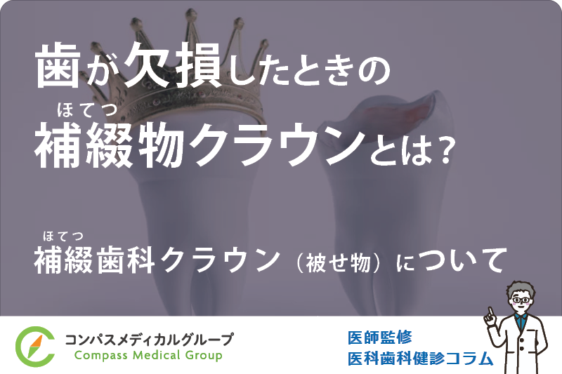 補綴歯科クラウン（被せ物）について | 歯が欠損したときの補綴物クラウンとは？