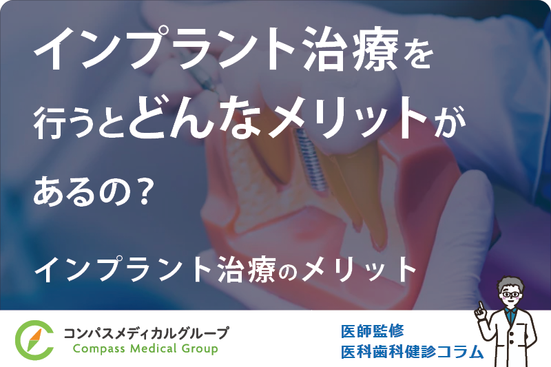 インプラント治療のメリット | インプラント治療を行うとどんなメリットがあるの？