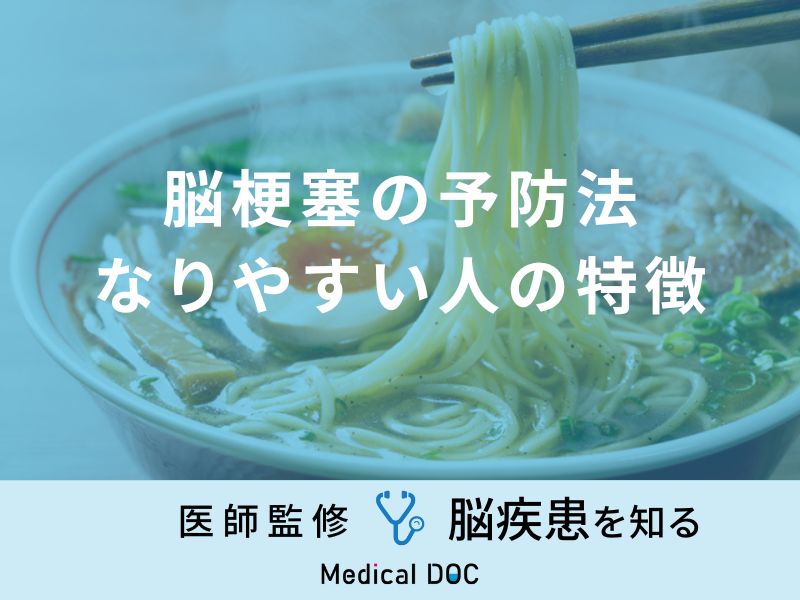 「脳梗塞の予防法・なりやすい人の特徴」はご存知ですか？医師が徹底解説！