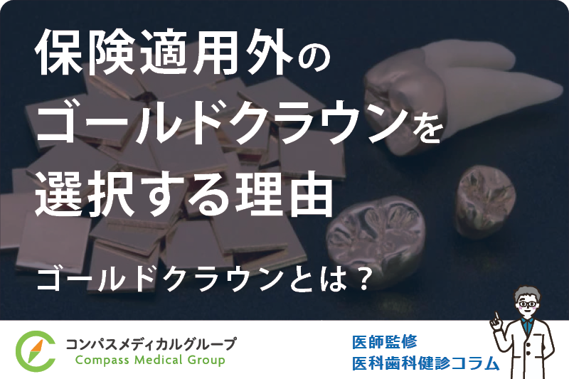 ゴールドクラウンとは？ | 保険適用外のゴールドクラウンを選択する理由