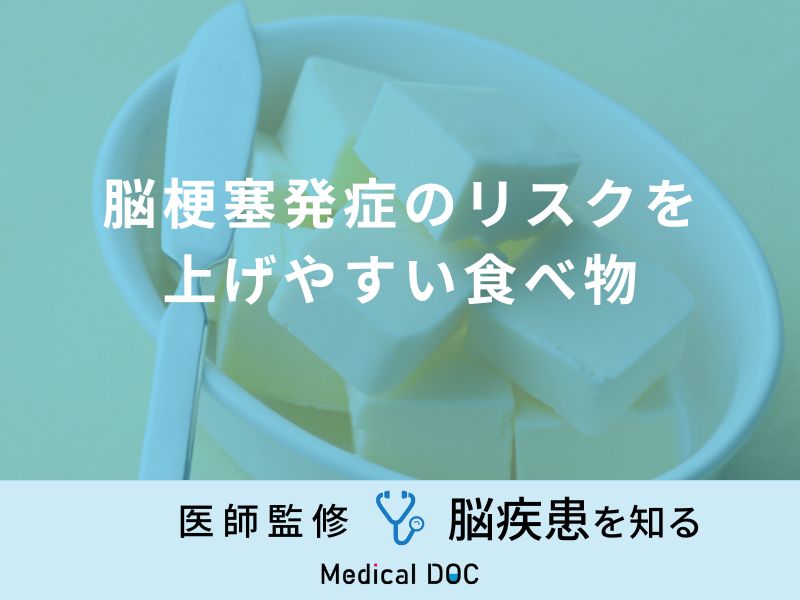 「脳梗塞」発症のリスクを上げやすい「食べ物」はご存知ですか？医師が解説！