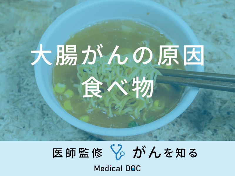 「大腸がんの原因」となる可能性の高い食べ物はご存知ですか？医師が解説！