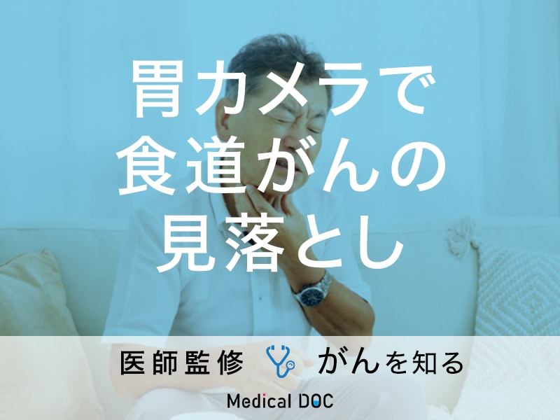 「胃カメラで食道がんを見落とす」ことはある？初期症状やなりやすい人の特徴も解説！