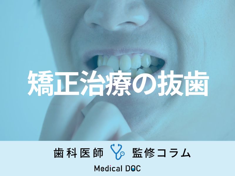 矯正治療で歯を｢抜く･抜かない｣の判断基準は? 抜歯が必要な理由やメリット･デメリットを解説