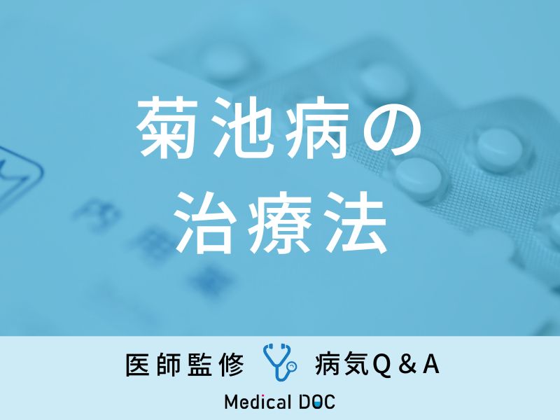 「菊池病の治療法」はご存知ですか？検査方法や何科を受診すればいいかも解説！