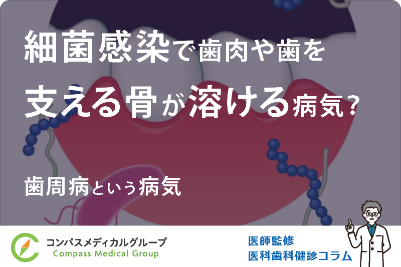 歯周病という病気 | 細菌感染で歯肉や歯を支える骨が溶ける病気？