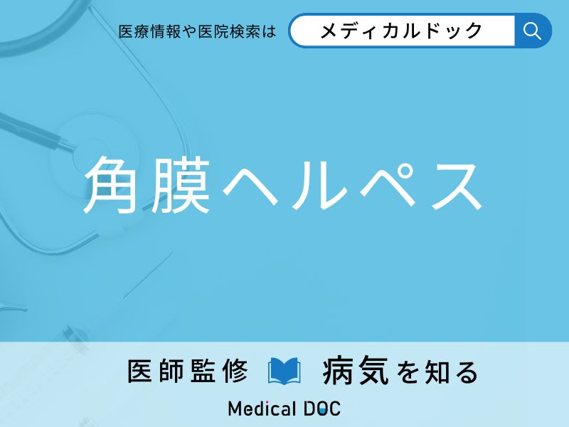 「角膜ヘルペス」を疑うべき初期症状はご存知ですか？ 原因を併せて医師が解説