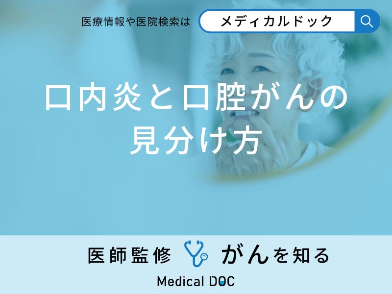 「口内炎と口腔がんの見分け方」はご存知ですか？口腔がんの初期症状も医師が解説！