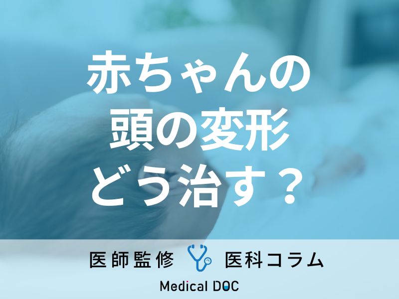 「赤ちゃんの頭の形」が変形する原因はご存じですか? 放置のリスクや治療法も医師が解説!